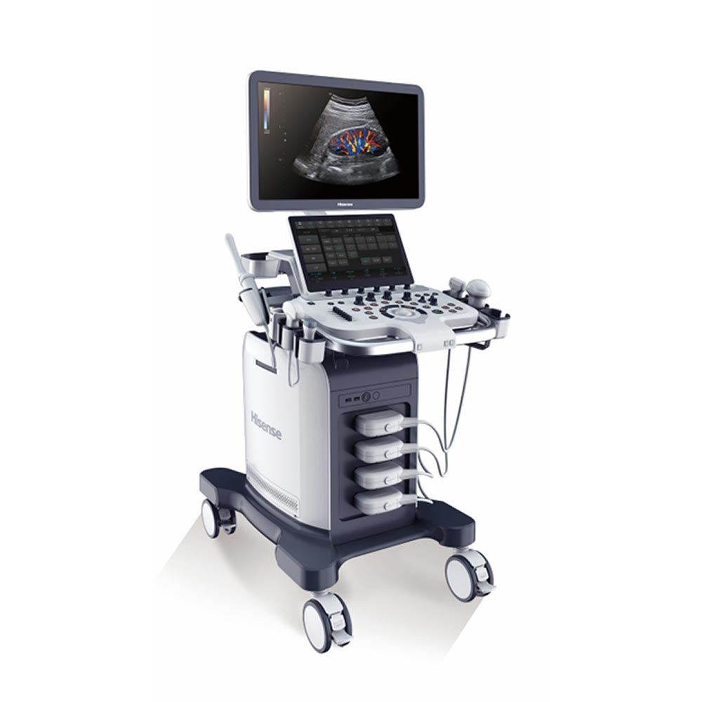 hisense ultrasound system