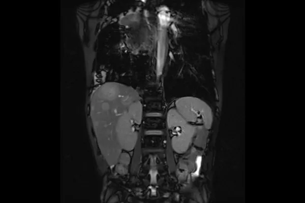 abdomen-imaging