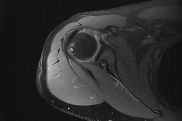 musculoskeletal-imaging