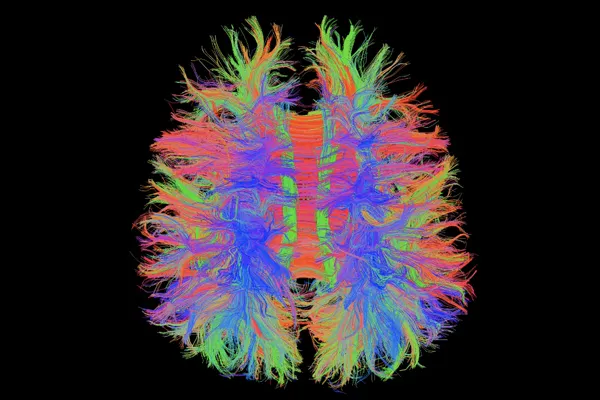 neuro-imaging