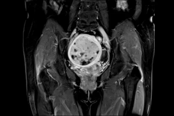 pelvis-imaging