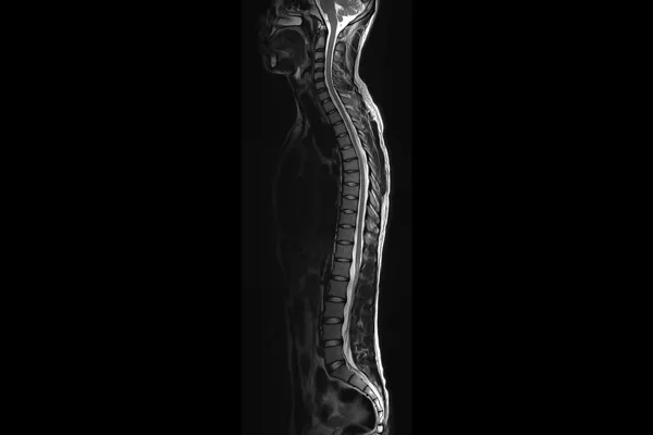 spinal-imaging