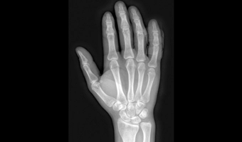 u-arm-dr-system-clinical-imaginig-4