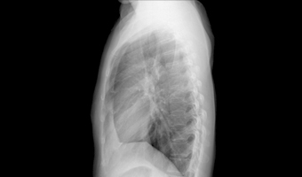 u-arm-dr-system-clinical-imaginig