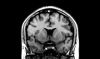 wdm-open-mri-clinical-image-1