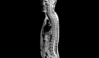 wdm-open-mri-clinical-image-2