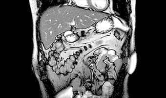 wdm-open-mri-clinical-image-3
