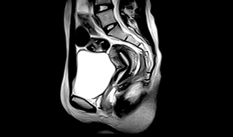 wdm-open-mri-clinical-image-4