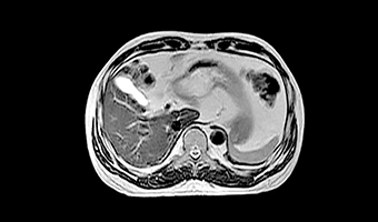 wdm-open-mri-clinical-image-5