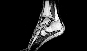 wdm-open-mri-clinical-image-6