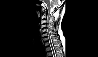 wdm-open-mri-clinical-image-7