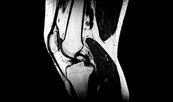 wdm-open-mri-clinical-image-8